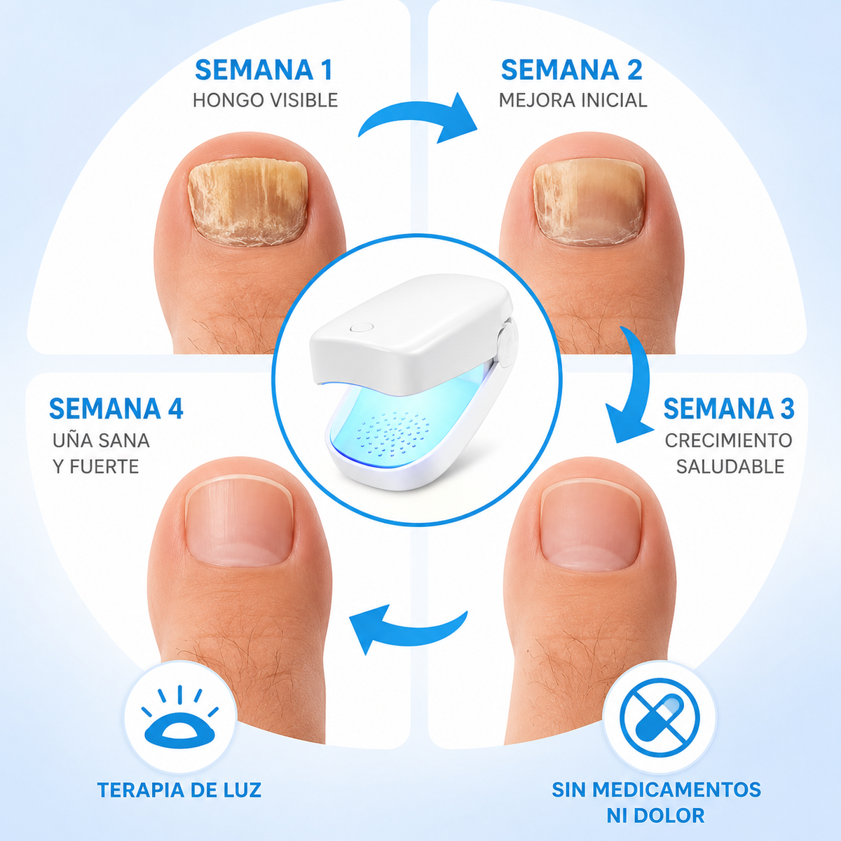 LASER PRIMIUM PARA UÑAS + TERBINAFINA AL 8% DE REGALO.