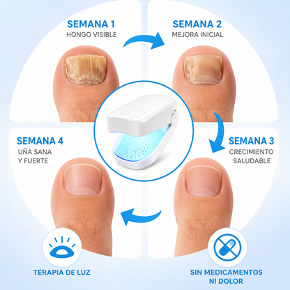 LASER PRIMIUM PARA HONGOS DE UÑAS